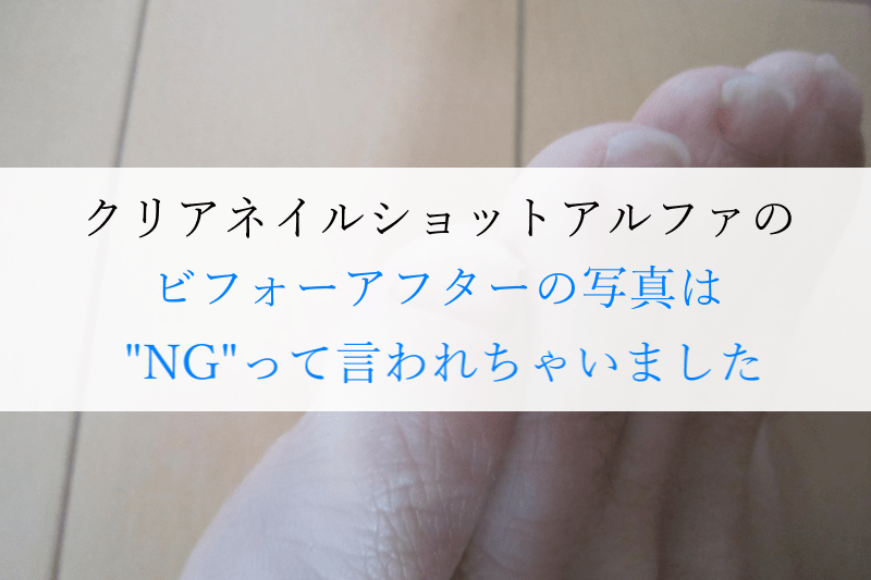 ビフォーアフターの写真はNG